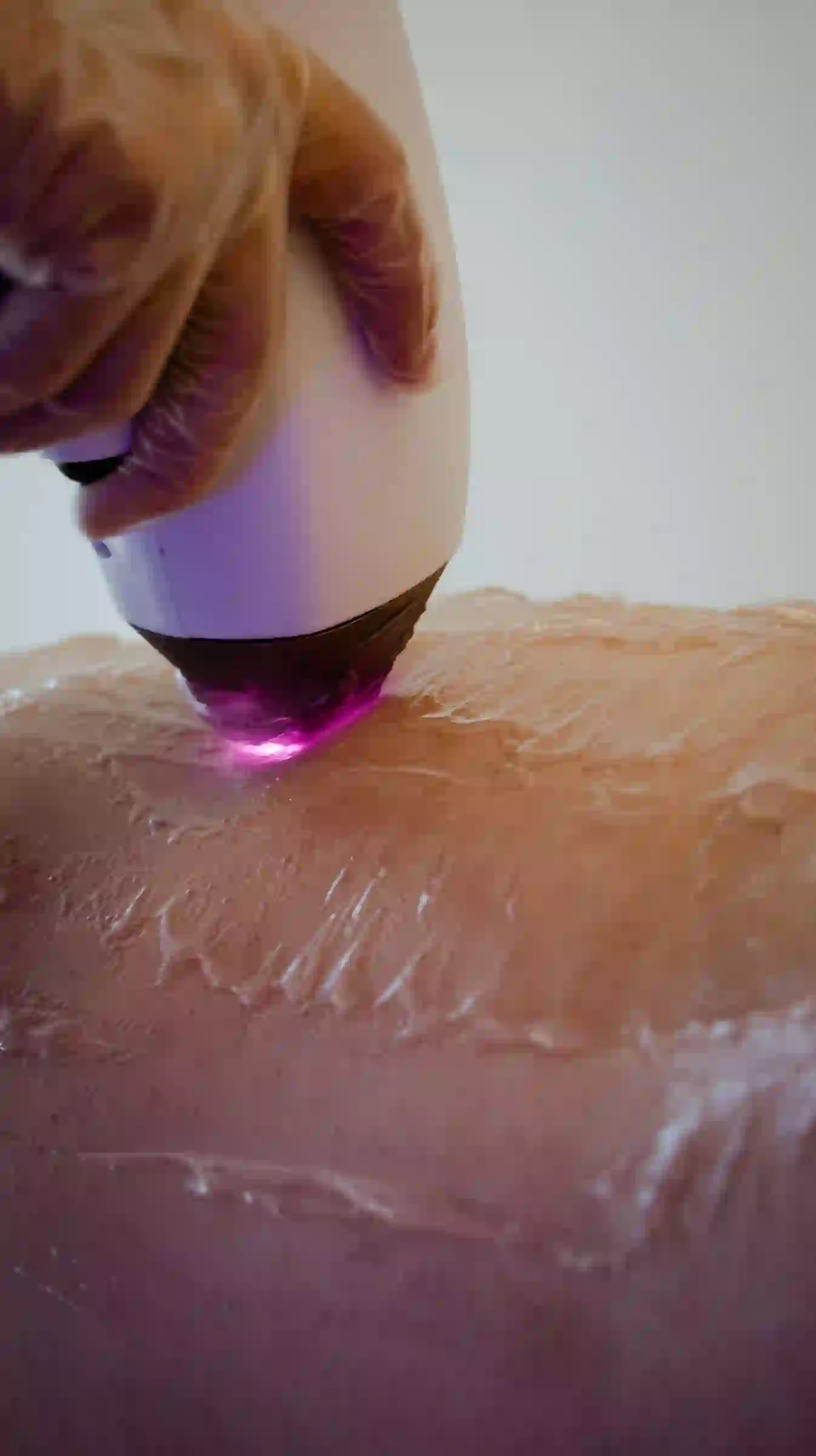 Average Cost Of Full Body Laser Hair Removal
